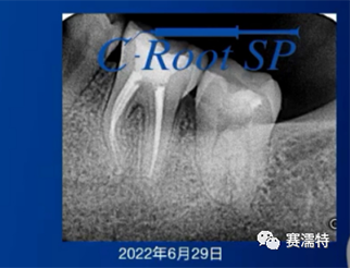 羅紫亮老師案例