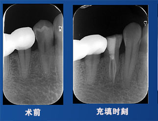 馬月英老師案例